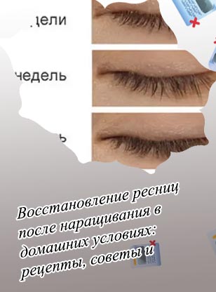 Как восстановить ресницы после наращивания за неделю