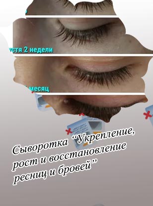 Ресницы укрепление и рост отзывы